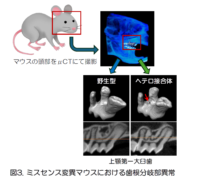 側頭骨蝶形骨と無血手術と17症候群 研究成果】鎖骨頭蓋異形成症の新たな病態モデルを確立 〜Runx2の